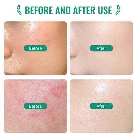 IREV Madagascar Centella Calming Toner - Soothing & Hydrating