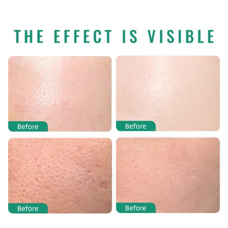 IREV Madagascar Centella Sun Repair Serum - Lightweight Daily Serum