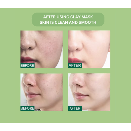 Kimsly Aloe Vera Clay Mask - Hydrating & Soothing Face Mask (100g)