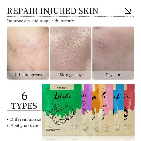 Kormesic Hydrating Centella Vitamin C Facial Mask Sheets (6 pack)